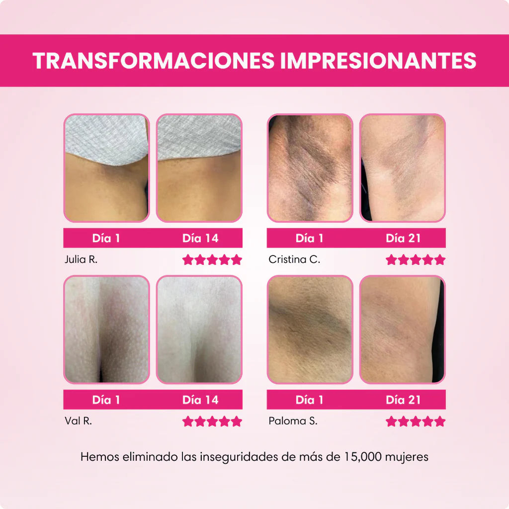 SKIN&GLOW ™ - Crema Aclarante